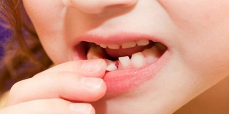 Mơ thấy gãy răng hàm dưới mang đến điềm báo tốt